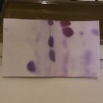 ELECTROFORESIS DE PROTEÍNAS